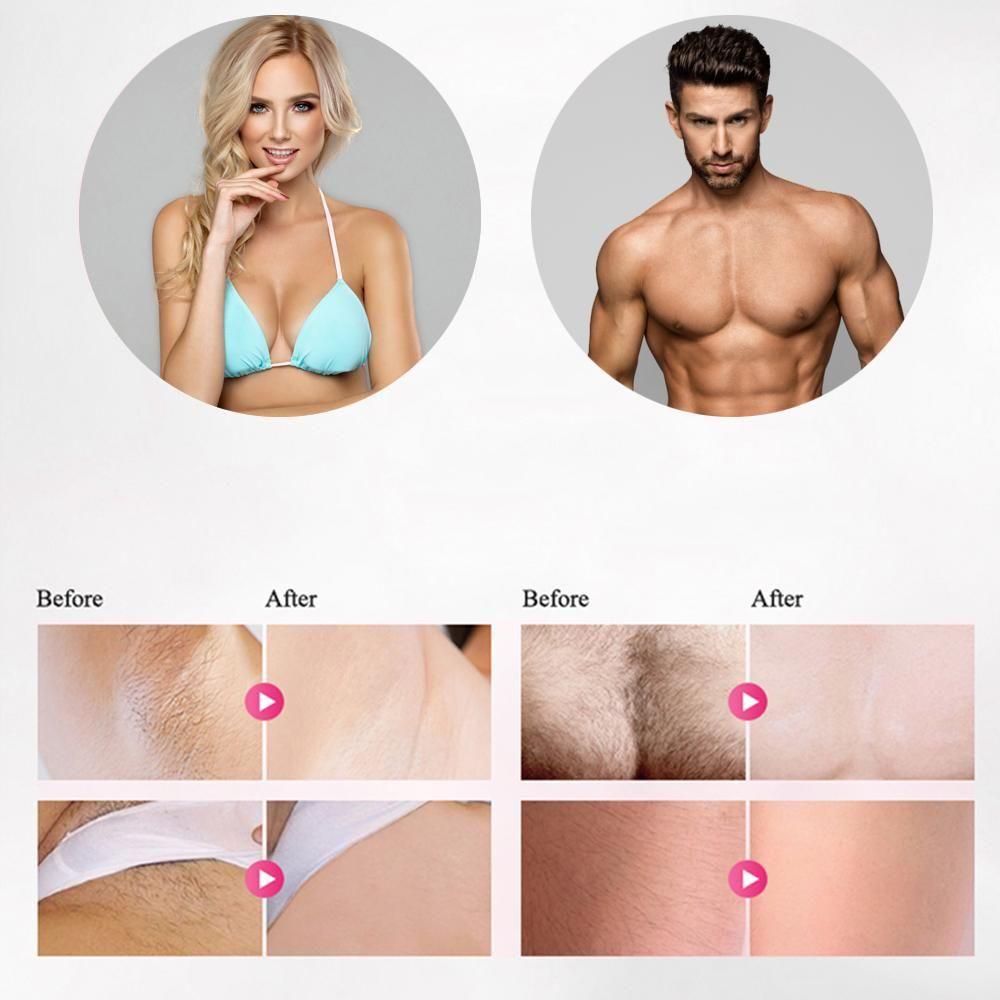 kaufsy | Professioneller IPL Epilierer Laser-Haarentfernung