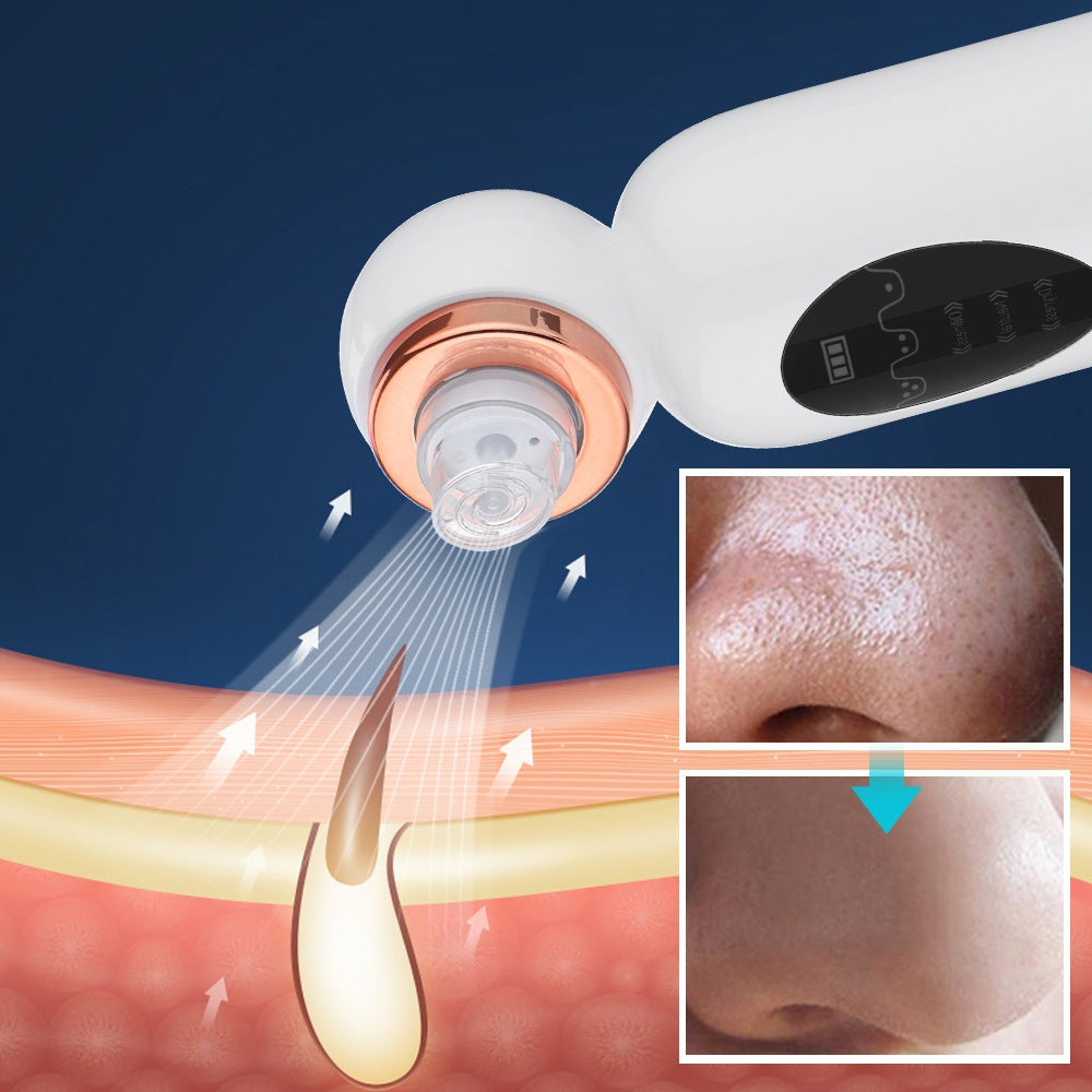 kaufsy | Hydrodermabrasion Mitesserentferner