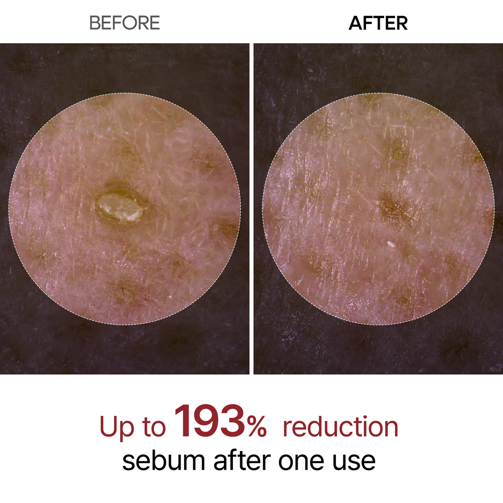 Reiswasser Peeling Ampulle, sanft, für Gesicht & Körper, empfindliche Haut