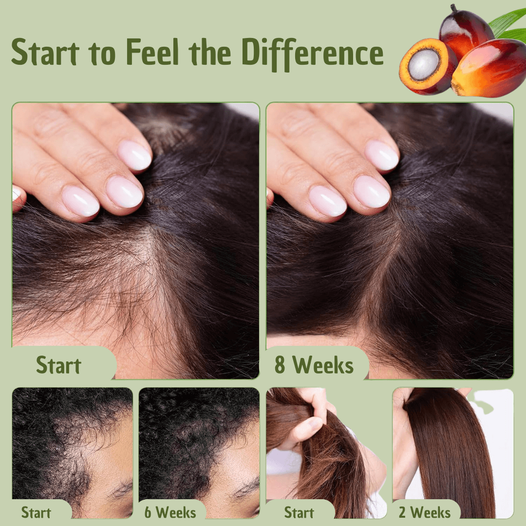 Batana Hair Oil – Nährende Haarpflege mit Omega-Fettsäuren & Vitamin E für Glanz, Stärke & Feuchtigkeit